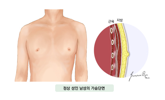 남성유방암 발생부위 : 정상 성인 남성의 가슴단면, 근육, 지방