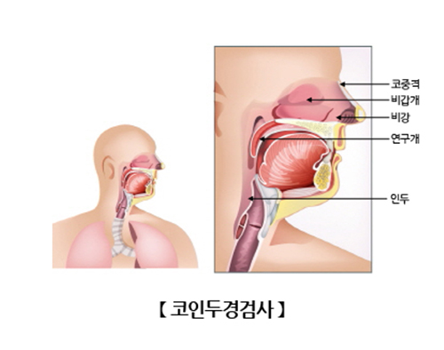 코인두경검사