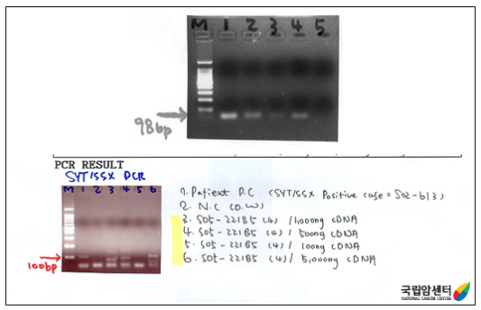 병리학적 검사 중 세포유전학적 검사
