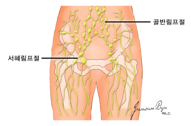 하지의 주요한 림프계 구조 - 골반림프절, 서혜림프절