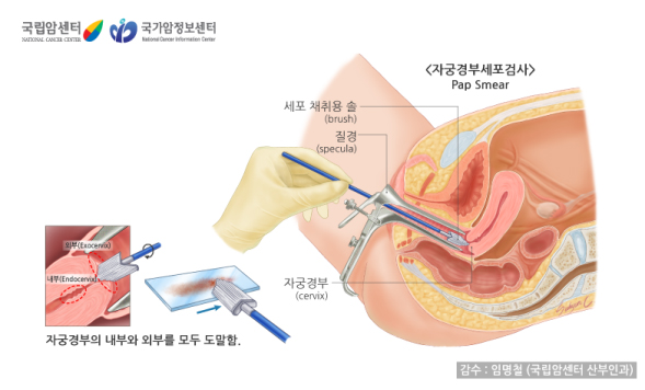 자궁경부세포검사 자궁경부세포검사