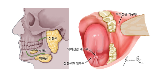 3쌍의 주타액선과 구강내 개구부 - 이하선, 설하선, 악하선,  이하선관 개구부, 악하선관 개구부, 설하선관 개구부