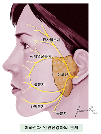 이하선과 안면신경과의 관계 -관자엽분지, 광대얼굴분지, 이하선, 볼분지, 하악분지, 목분지