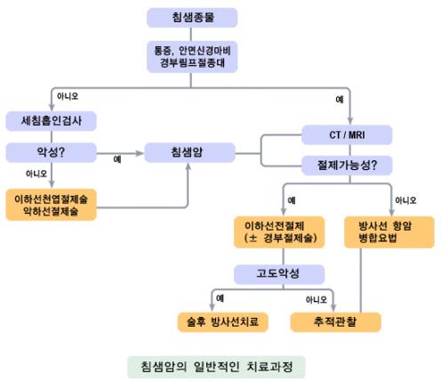 침샘종물, 통증, 안면신경마비 경부림프절종대, 세침흡인검사, 악성, 침샘암, 이하선천엽절제술 악하선절제술, CT/MRI, 절제가능성, 이하선전절제(± 경부절제술), 방사선 항암 병합요법, 고도 악성, 수술 후 방사선 치료, 추적관찰